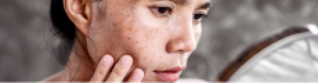 5 Kebiasaan Buruk Yang Bikin Kulit Cepat Kusam