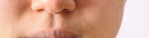 Gambar Artikel Cara Mengatasi Kulit Kering Dengan Skincare Tepat