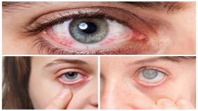 Katarak Sebagai Penyebab Penurunan Penglihatan Pada Usia Dewasa