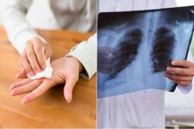 Gambar Artikel Ketahui Penyebab dan Gejala Paru paru Basah